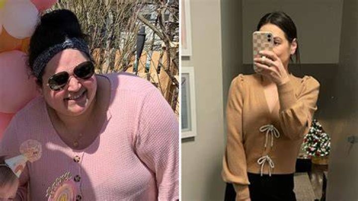 Amy Kane is a Chicago woman who alleges to have shed 170 pounds with the help of the Mounjaro drug. - SarkariResult