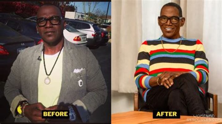 Did Randy Jackson Undergo Plastic Surgery?