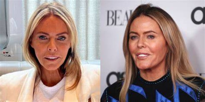 Patsy Kensit and Plastic Surgery: Examining the Facts and Separating Truth from Speculation Regarding Patsy Kensit's Cosmetic Procedures. - SarkariResult