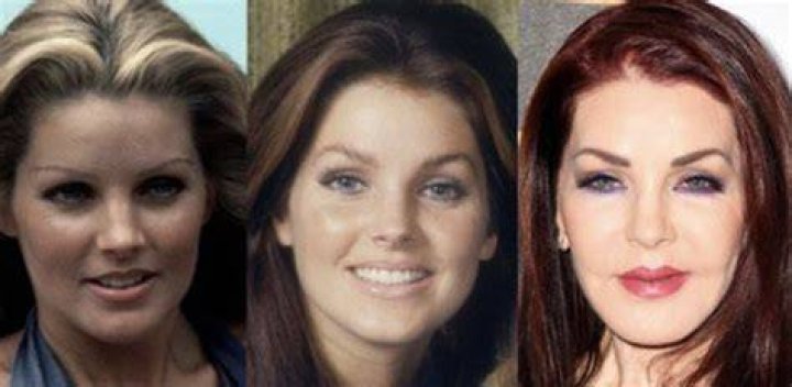 Priscilla Presley: All About Her Plastic Surgery, Before and After Pictures - SarkariResult