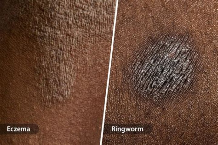 Ringworm Black / Snake