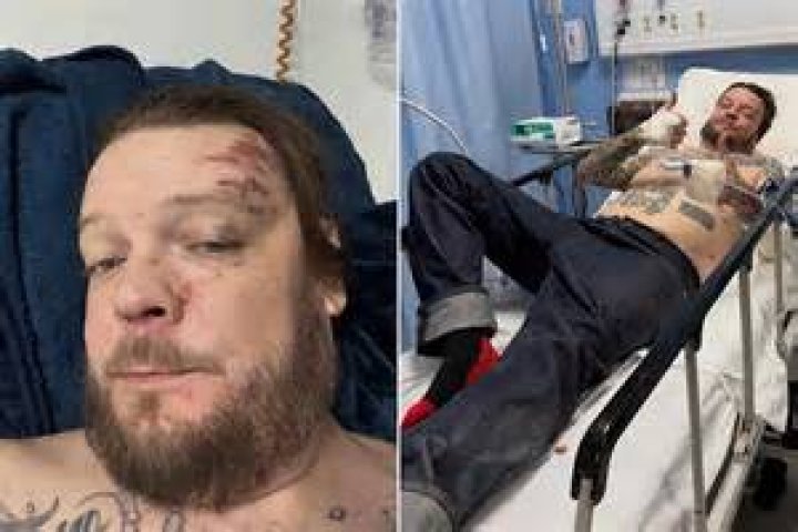 What's Going On with Corey From Pawn Stars? Any Truth to the Rumors of a Stroke? - SarkariResult
