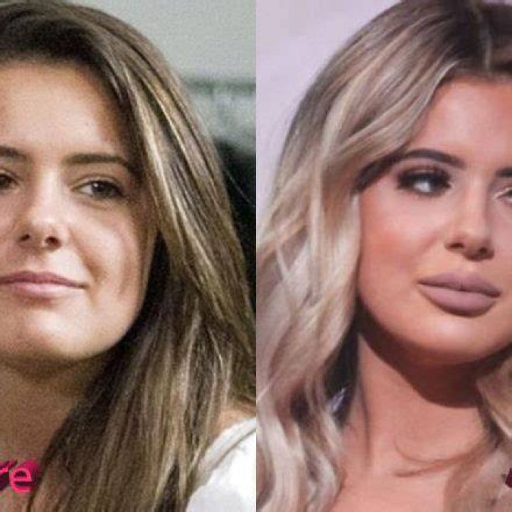 Who is Brielle Biermann? Has She Had Plastic Surgery? Know All About Him - SarkariResult